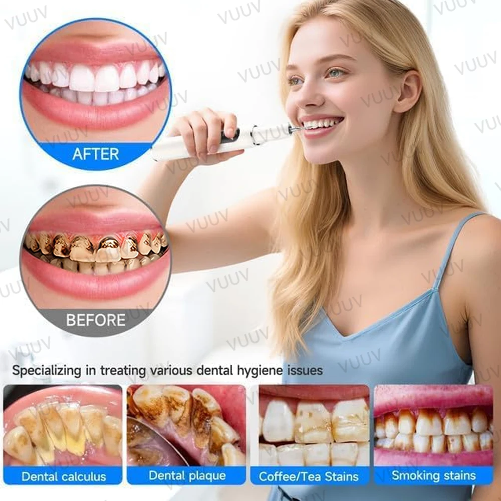 VUUV Ultrasonic Teeth Cleaner  - Teeth Whitening Uv recension och pris