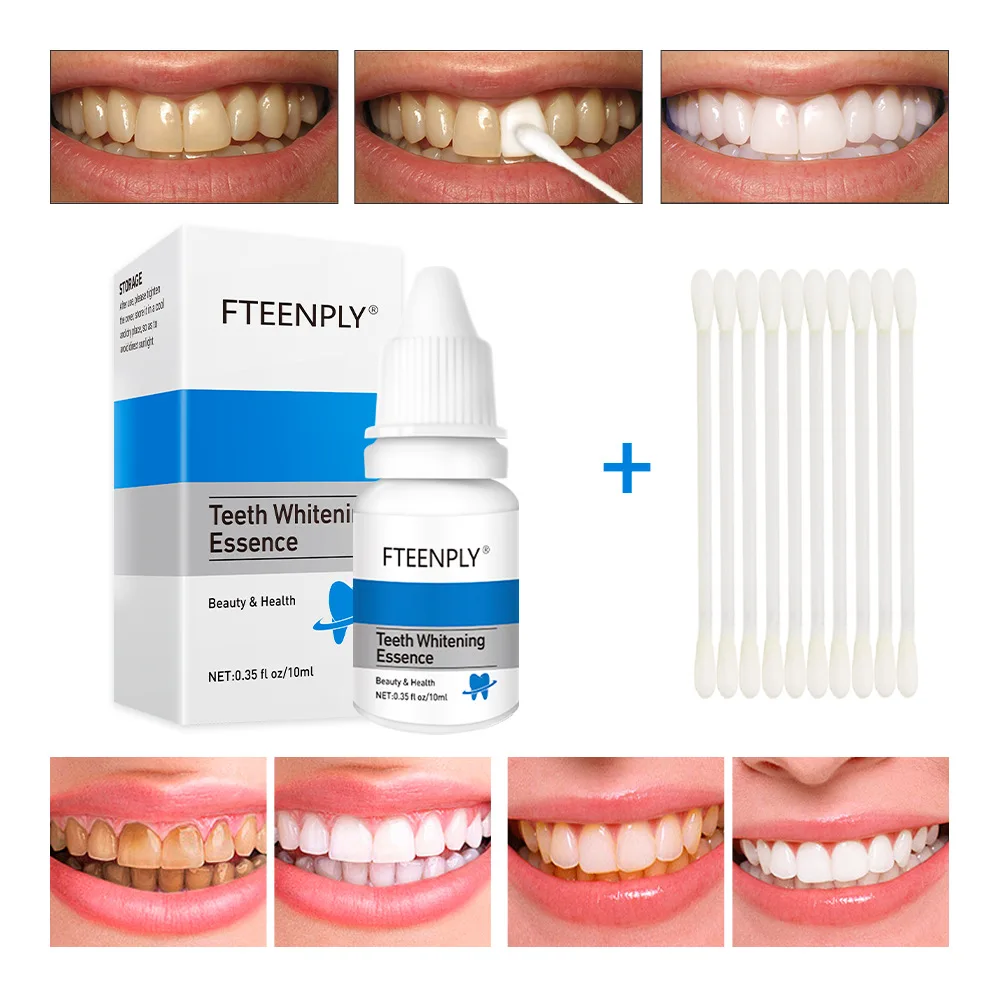 FTEENPLY Teeth Whitening Essen - Teeth Whitening Procedure recension och pris