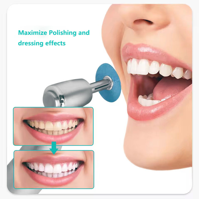 40pcs Dental Polishing Discs H - Teeth Whitening Uk recension och pris