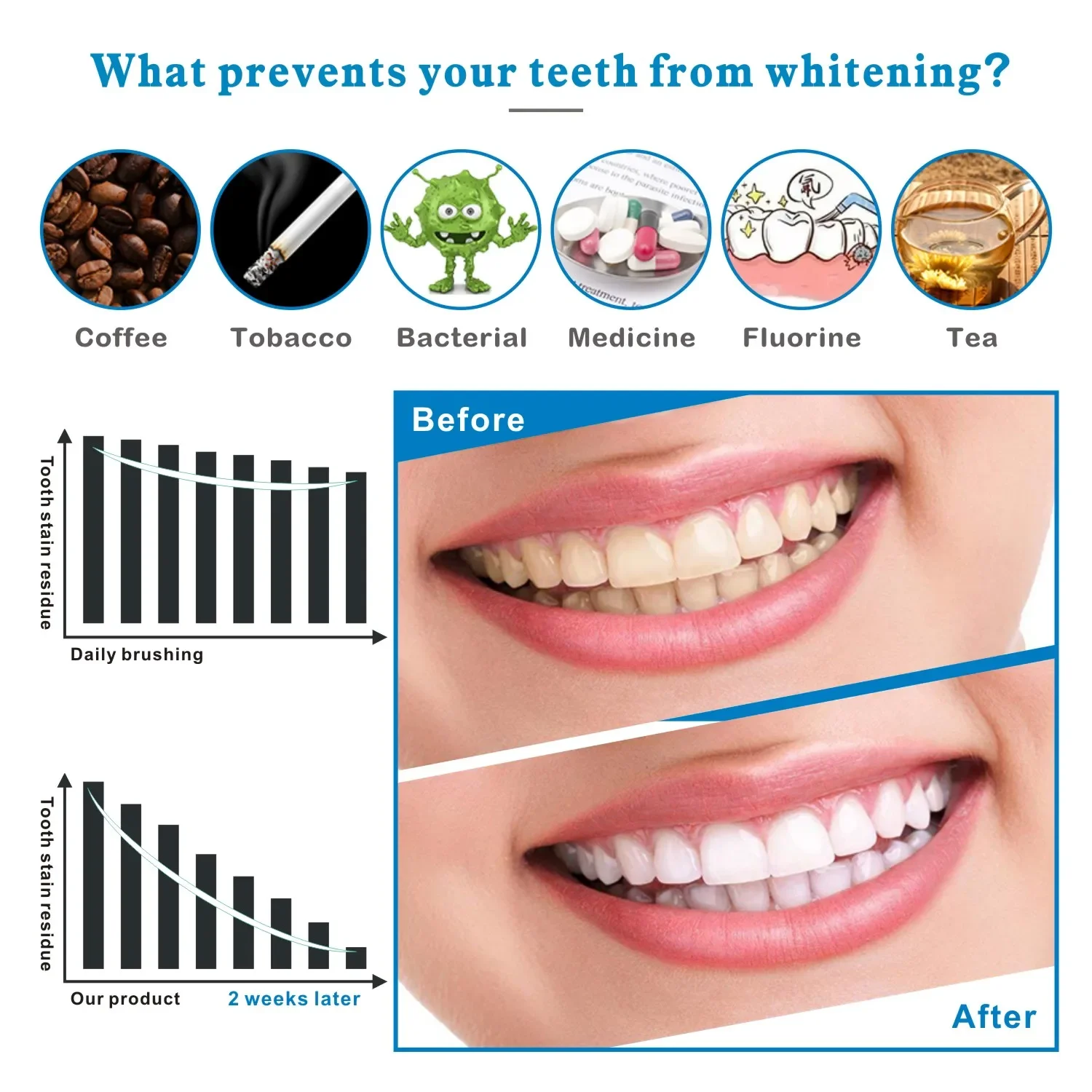 14/28pcs 3D Teeth Whitening St - Whitening Strip 3D recension och pris