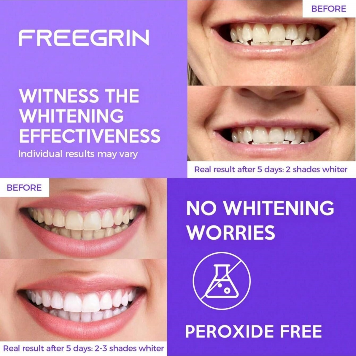 Deluxe Whitening Teeth Sticker - Teeth Whitening With Hydrogen Peroxide recension och pris