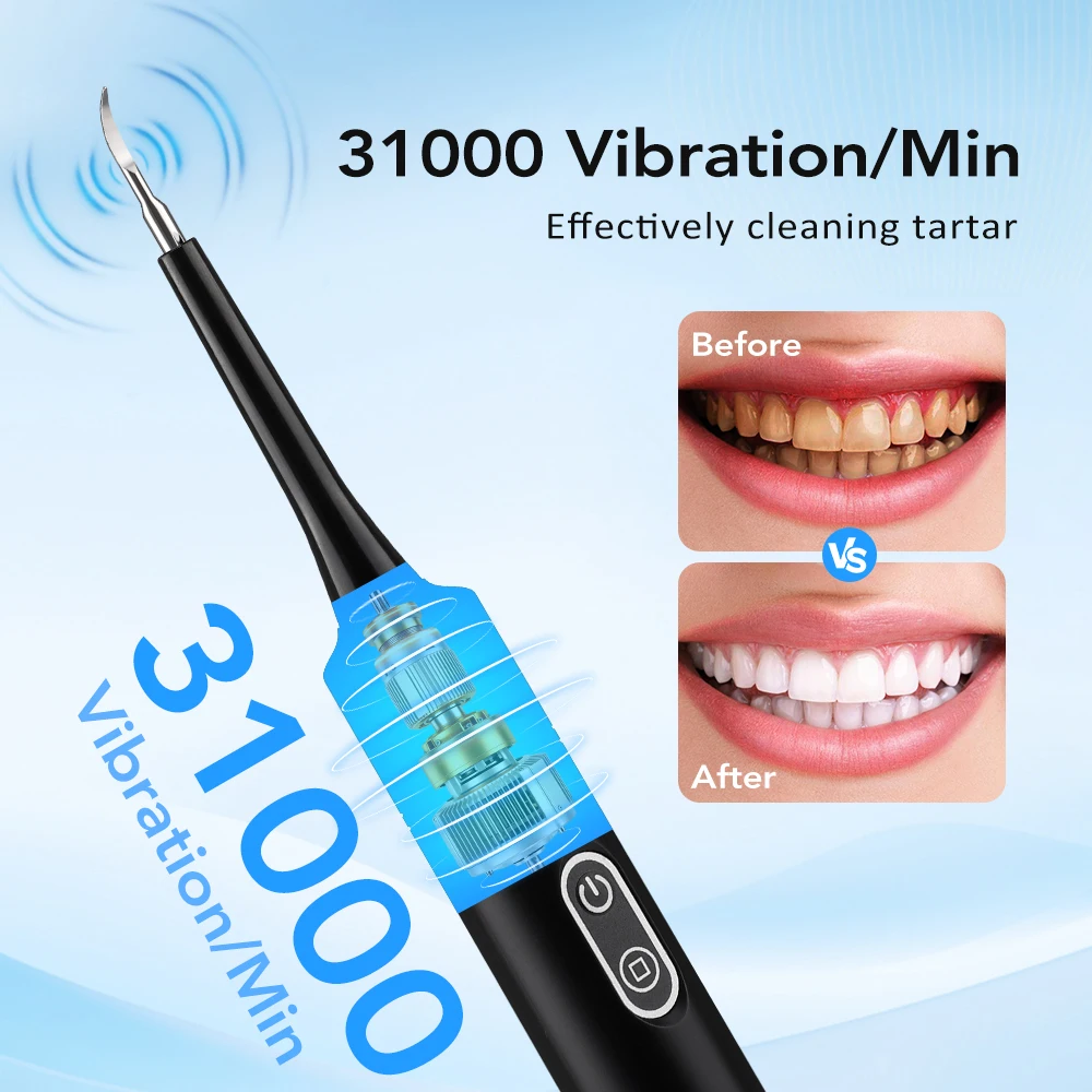 Electric Sonic Vibration Denta - Teeth Whitening Uk recension och pris